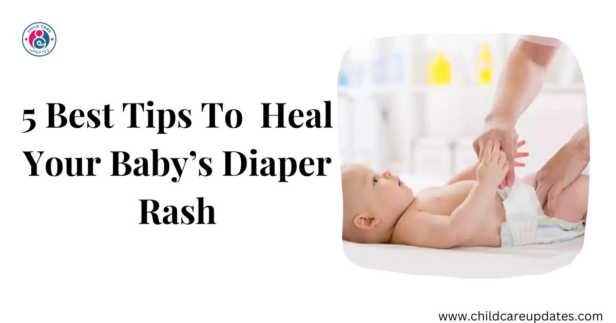 Baby’s Diaper Rash