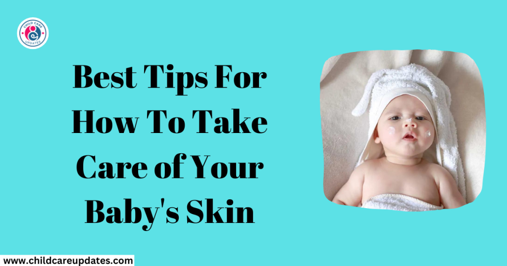 take care of your baby's skin